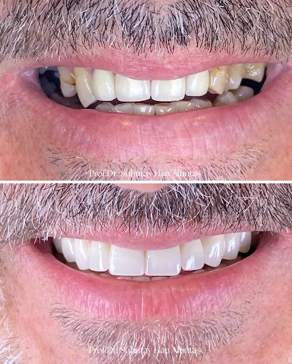 Prof. Dr. Subutay Han Altıntaş – Diğer (Güzellik), İstanbul (3. fotoğraf)