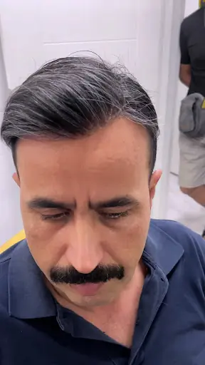 Woyn Protez Saç Güzellik Merkezi 2