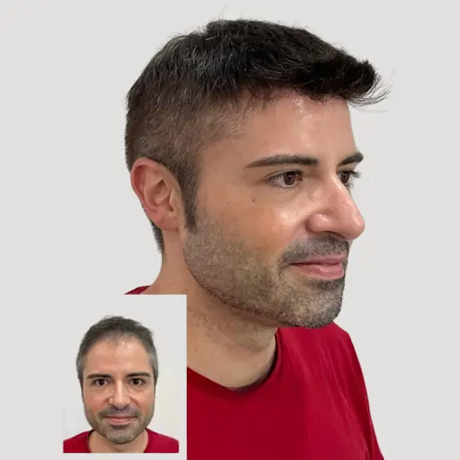 HAİR TECHNİCAL PROTEZ SAÇ MERKEZİ 5