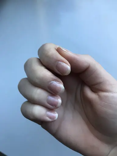 Mavi Damla Güzellik ve Estetik Merkezi 4