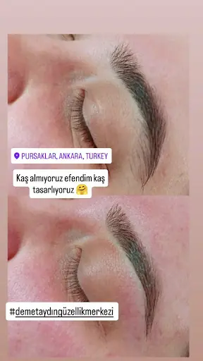 Demet Aydın Güzellik Merkezi pursaklar 4
