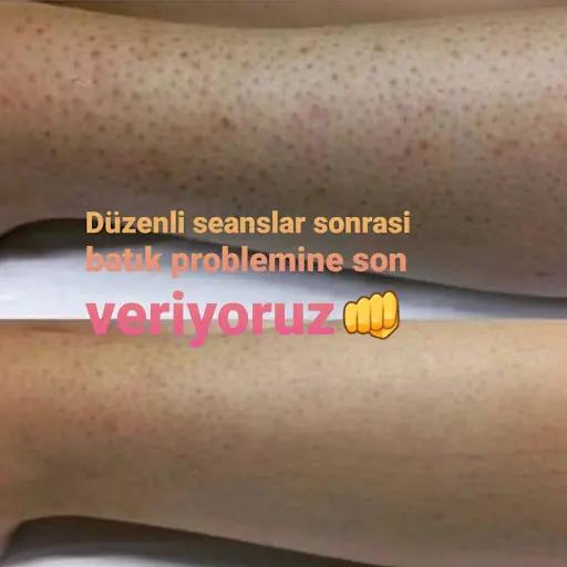 Lavinya Güzellik Salonu