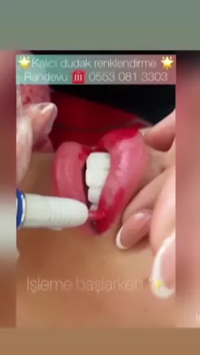 Elegans Güzellik Salonu | Buz Lazer Epilasyon | Soprano Titanium | Cilt Bakımı | G5 Masajı 3