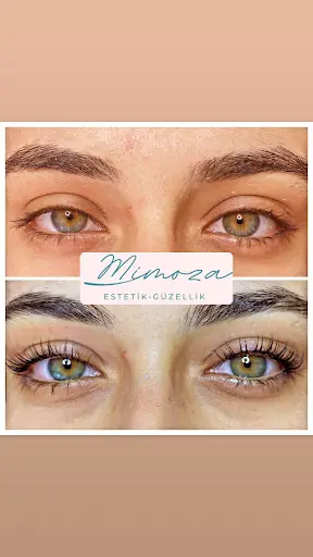 Isparta/Mimoza Estetik ve Güzellik Merkezi 4