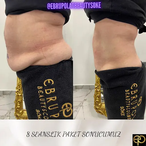 Ebru Polat Beauty Söke 4