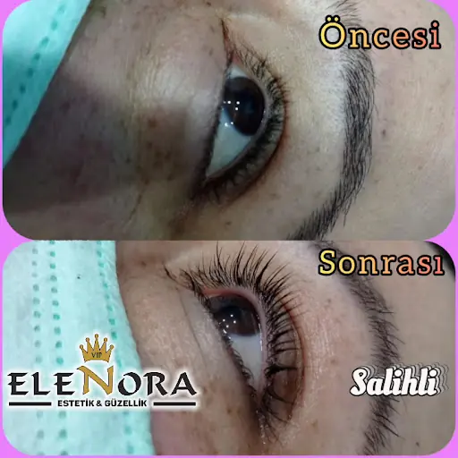 Elenora Güzellik Merkezi Salihli 3