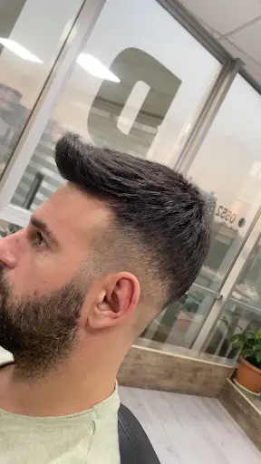 Protez saç Murat YILDIRIM 2