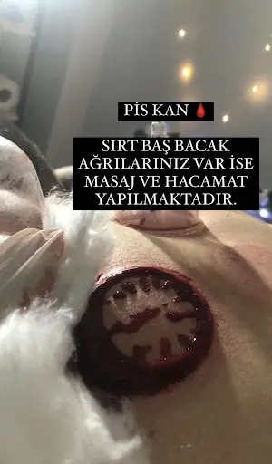 TRABZON MASAJ MERKEZİ