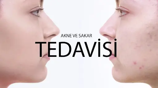 Hasret Güzellik ve Estetik 3