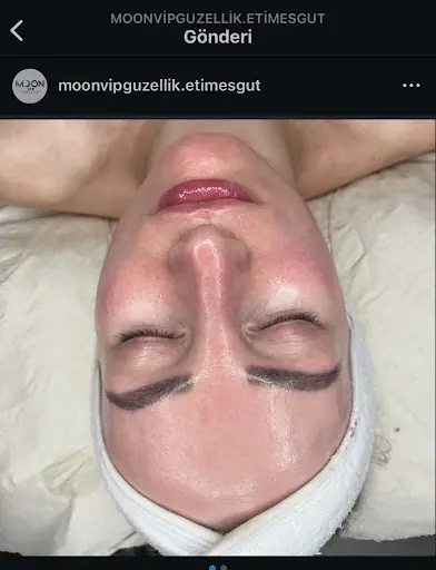 Moon Vip Güzellik 3