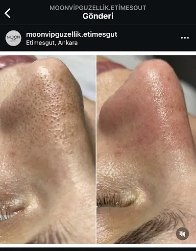 Moon Vip Güzellik 2