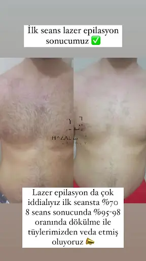 Hazal Babalık Beauty Antalya