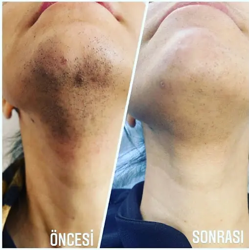 Lavinya Güzellik Salonu 2