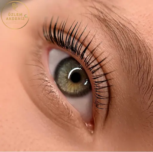 ÖZLEM AKDENİZ BEAUTY CENTER-Afyon Güzellik Merkezi,Leke Tedavisi,Protez Tırnak,Erkek Lazer Epilasyon,İpek Kirpik,Cilt Bakımı