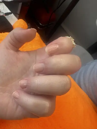 Kader Bayan Kuaföru Ve Güzellik Salonu Lazer Epilasyon 2