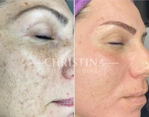 Fatma Önat Beauty Studio Sakarya Güzellik Merkezi 2