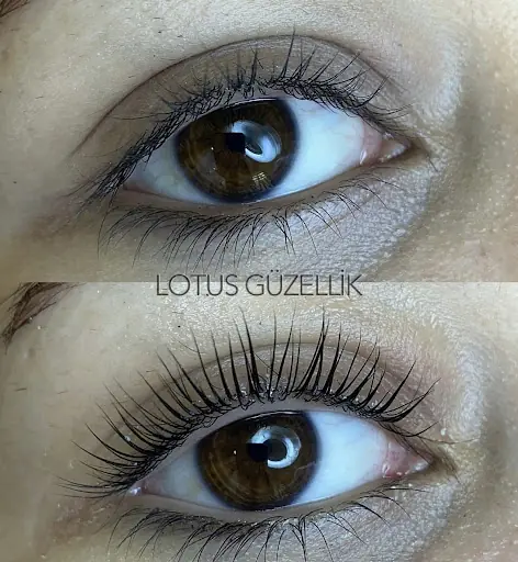 Lotus Güzellik