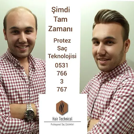 HAİR TECHNİCAL PROTEZ SAÇ MERKEZİ