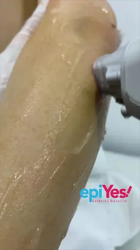 Epiyes Estetik Güzellik 3