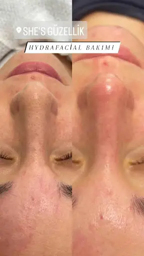 She's Güzellik 3