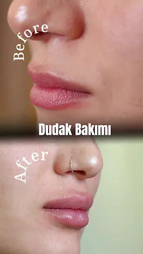 Best İstanbul Güzellik Merkezi I Lazer Epilasyon I Cilt Bakımı I Bölgesel İncelme I Kalıcı Makyaj / BATMAN 4