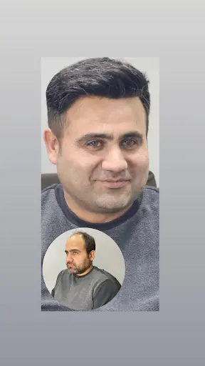 SOLO HAİR PROTEZ SAÇ