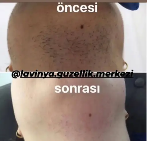 Lavinya Güzellik Salonu 3