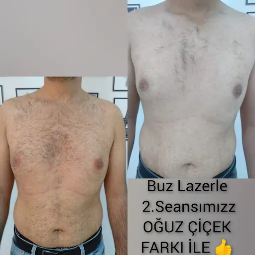 Oğuz Çiçek vip erkek bakim merkezi 4