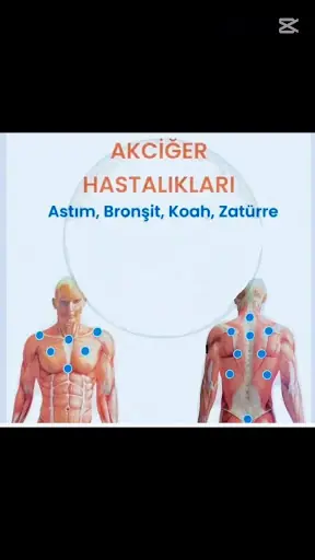 Sandıklı Hacamat ve masaj hizmetleri 3