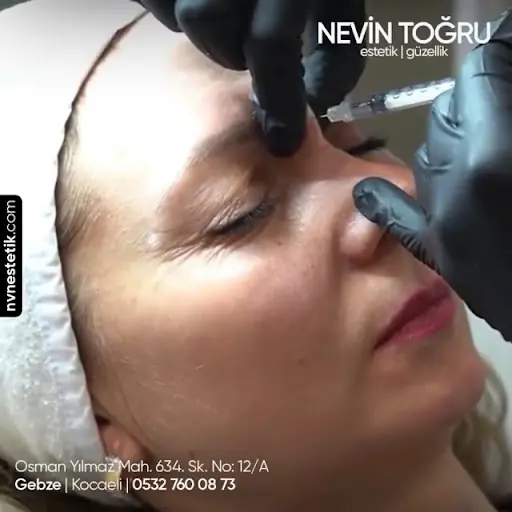 NVN NEVİN TOĞRU ESTETİK VE GÜZELLİK 3