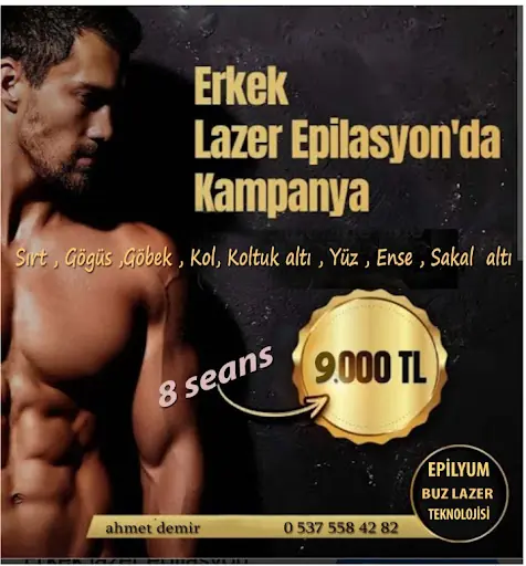 Foto mehmet & canan bayan kuaförü lazer epilasyon 3