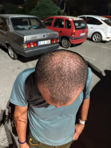 Epipera Güzellik Salonu – Güzellik Merkezi, İstanbul (3. fotoğraf)