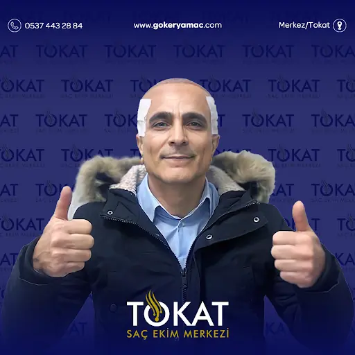 Tokat Saç Ekimi Merkezi | Tokat Hair Clinic 3