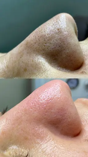 MerveBEAUTY/GüzellikSALONU 3