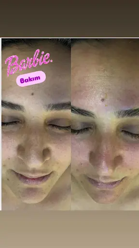 Şımarık güzellik Lazer epilasyon merkezi & Eylem beauty Cilt bakımları ve piercing stüdyo 3