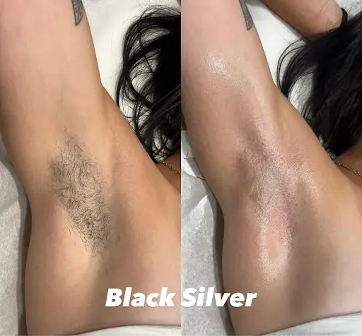Black Silver Güzellik - Zeytinburnu Güzellik Salonu