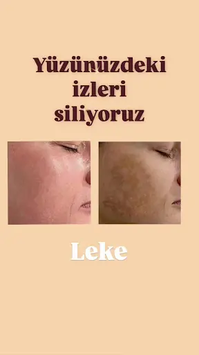 SEMİRAMİS GÜZELLİK MERKEZİ 3