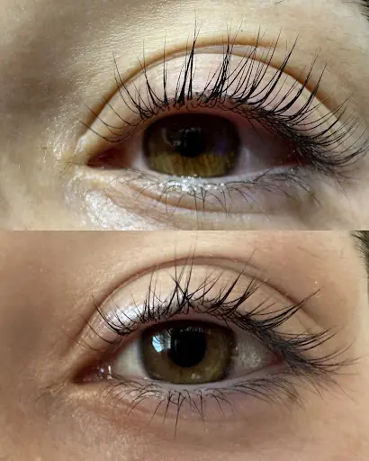 Yağmur Beauty Güzellik Salonu Bay Bayan lazer epilasyon cilt bakımı bölgesel incelme