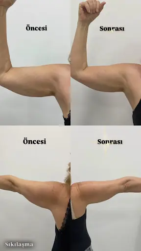 Ebru Polat Beauty Söke 3