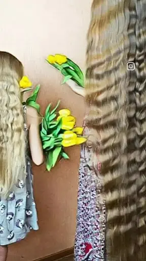 Erzurum Saç Ekim Merkezi Saç PRP`si | Altınsoy Hair Clinic 5