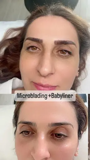 Şüheda Parlak Beauty Studio | Güzellik Salonu | Lazer Epilasyon | Güzellik Merkezi | Cilt Bakımı 3