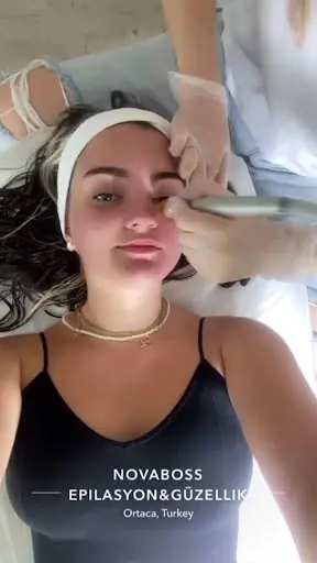 Novaboss Estetik Ve Güzellik