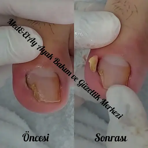 Medelay El-Ayak Bakım ve Güzellik Salonu 2