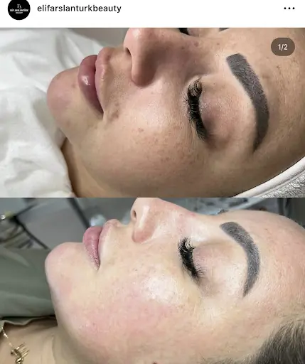 Elif Arslantürk Güzellik Merkezi 3