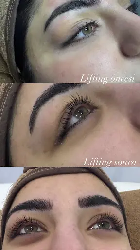 Alebra Beauty - Lazer Epilasyon, Cilt Bakımı, Kirpik Lifting, Kalıcı Makyaj, Manikür Pedikür 4