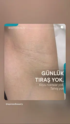 epimedbeauty 2