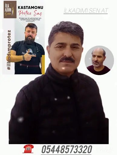 Kastamonu PROTEZ SAÇ MERKEZİ İlkadım 4