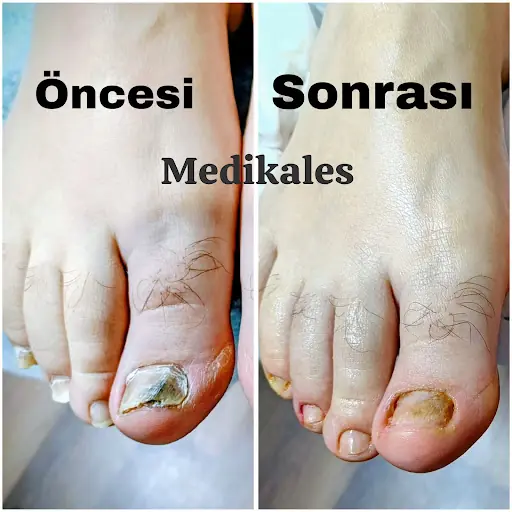 Medikales Güzellik & El Ayak Bakım Merkezi