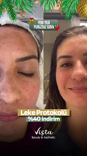 ENZA BEAUTY & AESTHETİC I KOCAELİ | İZMİT | GÜZELLİK MERKEZİ | LAZER EPİLASYON | CİLT BAKIMI | ZAYIFLAMA 3