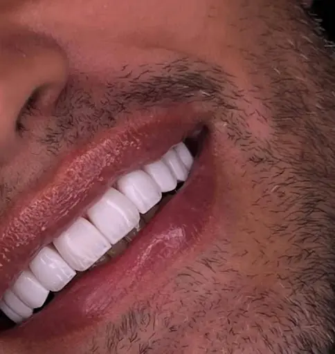 Sera Dental Avcılar Diş Kliniği - İmplant ve Estetik Diş Merkezi 3